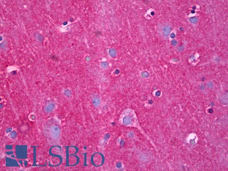 IHC-plus™ Monoclonal Mouse anti-Human NDRG4 Antibody (clone 2G3, IHC, WB)