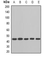 Polyclonal Rabbit anti-Human BCAT2 Antibody (WB)
