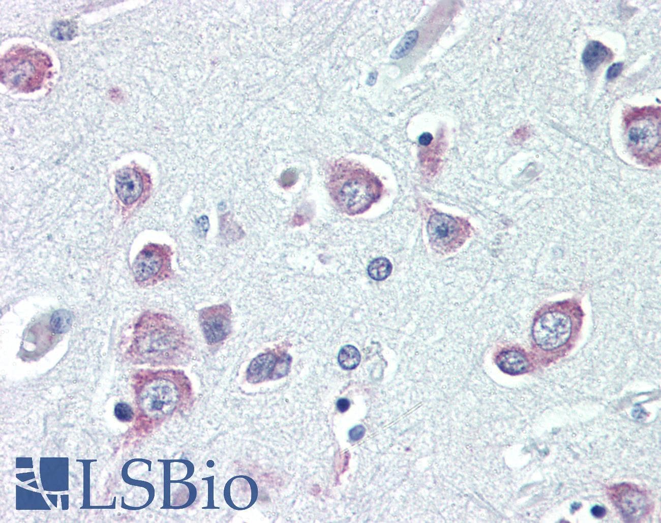 IHC-plus™ NIP3 / BNIP3 Antibody (aa112-124)