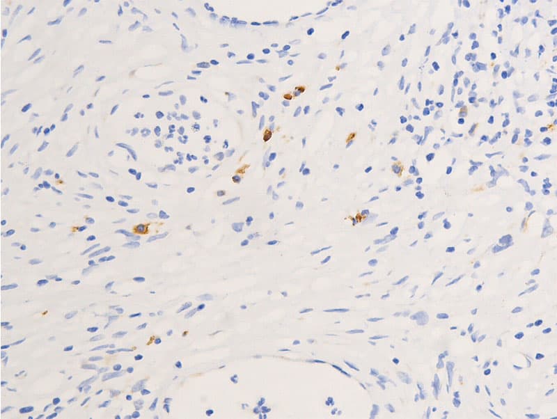 NR3C1/Glucocorticoid Receptor Antibody (phospho-Ser211)