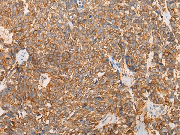 LRRC16 / CARMIL Antibody