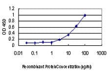 PRKCI / PKC Iota Antibody (clone 1G11)
