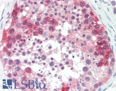 IHC-plus™ Polyclonal Rabbit anti-Human CTAG1B / NY-ESO-1 Antibody (IHC, WB)