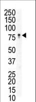 EPHB3 / EPH Receptor B3 Antibody (aa29-59)