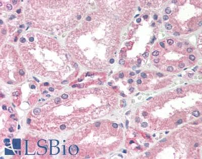 TET2 Antibody