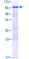 Human SCHIP1 Protein (Recombinant GST)