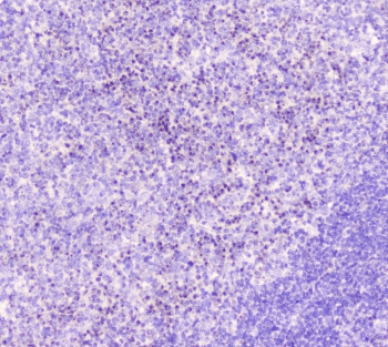 Polyclonal Rabbit anti-Human GOLGA2 / GM130 Antibody (IHC, WB)