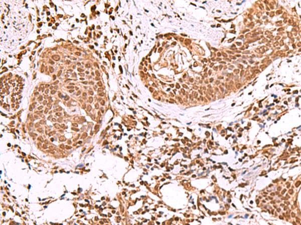 IP6K1 Antibody