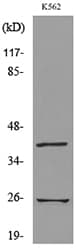 Polyclonal Rabbit anti-Human KLRB1 / CD161 Antibody (WB)