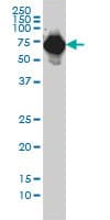 Monoclonal Mouse anti-Human Alpha-Fetoprotein Antibody (clone 1G7, IF, WB)