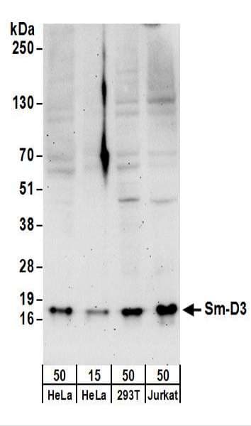 IHC-plus™ Polyclonal Rabbit anti-Human SNRPD3 Antibody (aa1-50, IHC, WB)