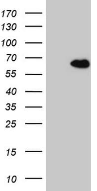 Monoclonal Mouse anti-Human CCDC36 Antibody (clone OTI2D11, IHC, WB)