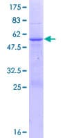 Human ABHD12B Protein (Recombinant GST)