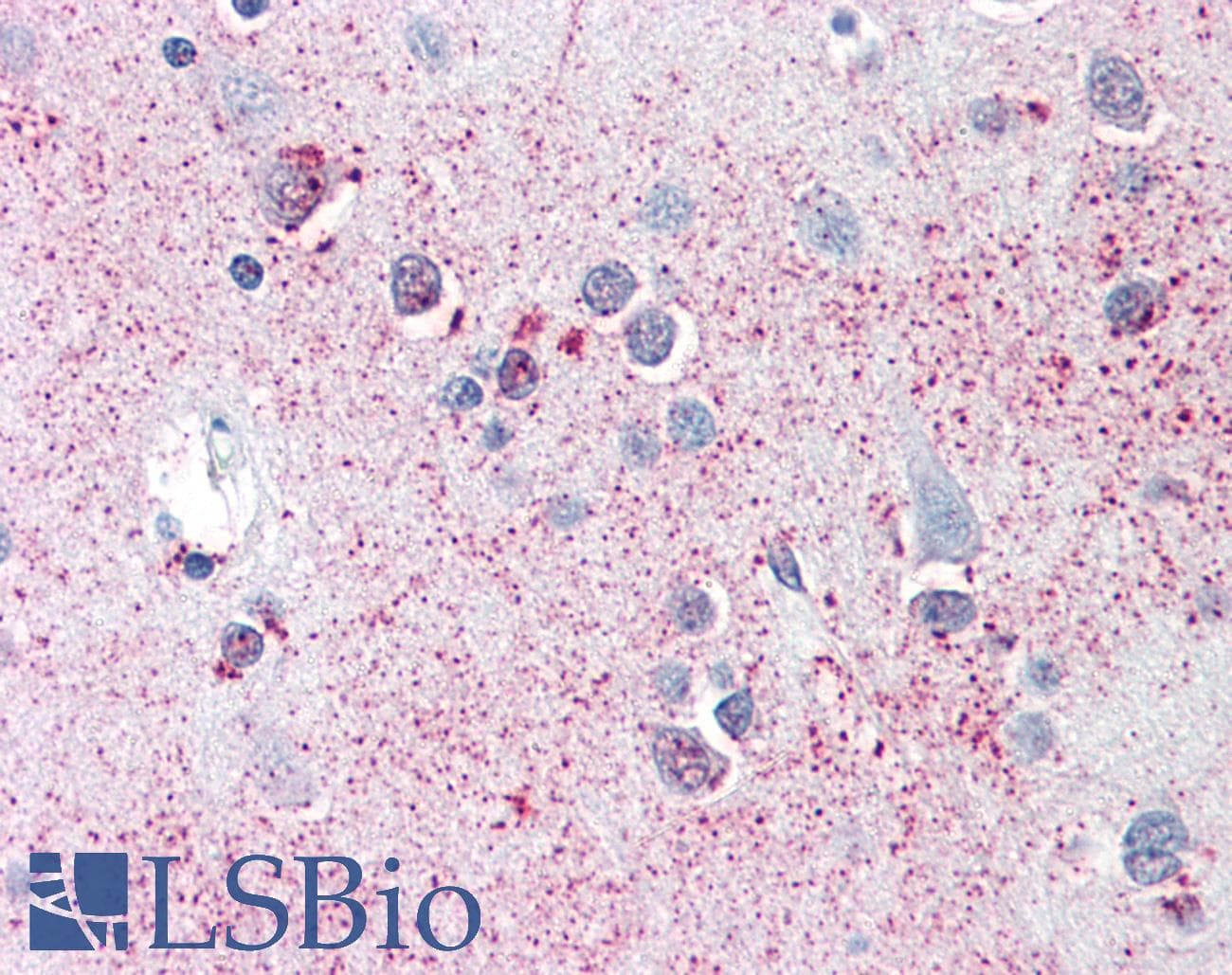 IHC-plus™ SRPX2 Antibody (C-Terminus)