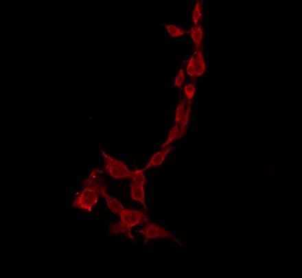 PPP1R14C / KEPI Antibody