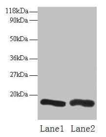 IHC-plus™ Polyclonal Rabbit anti-Human CHMP2A Antibody (IHC, WB)