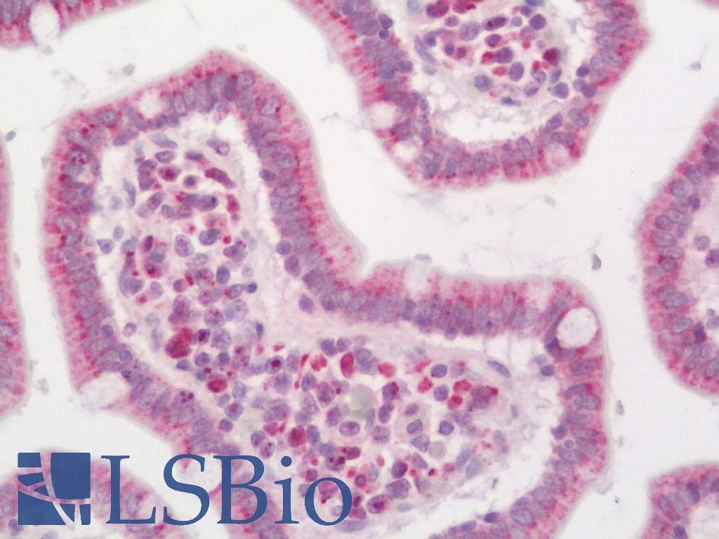 IHC-plus™ TM9SF2 Antibody (aa111-140)