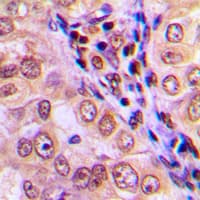 MAP3K4 / MEKK4 Antibody (C-Terminus)