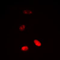 Histone H3 Antibody (Acetyl-Lys18)