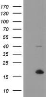TPD52L3 Antibody (clone OTI8C12)