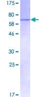 Human HELLS Protein (Recombinant GST)
