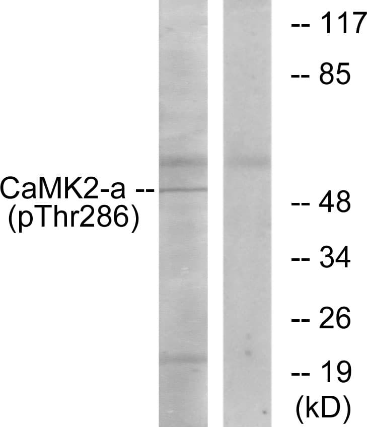 CAMK2 / CAMKII Antibody (phospho-Thr286)