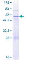 Human GLUP / PACRG Protein (Recombinant GST)