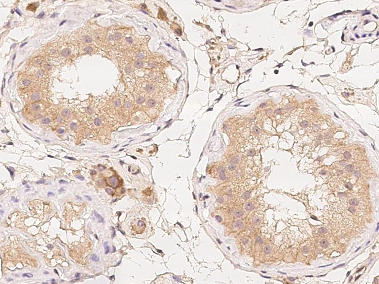 Polyclonal Rabbit anti-Human LMX1B Antibody (IHC)