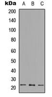 RPL18 / Ribosomal Protein L18 Antibody (Internal)