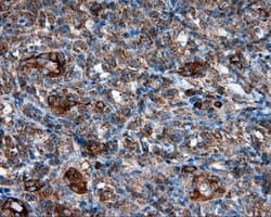 PIM2 / Pim-2 Antibody (clone OTI8G10)
