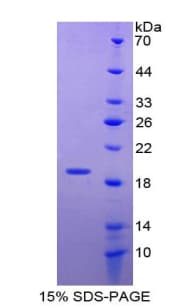 Mouse SOD1 / Cu-Zn SOD Protein (Recombinant His)