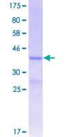 Human ITGB8 / Integrin Beta 8 Protein (Recombinant GST, N-terminus)