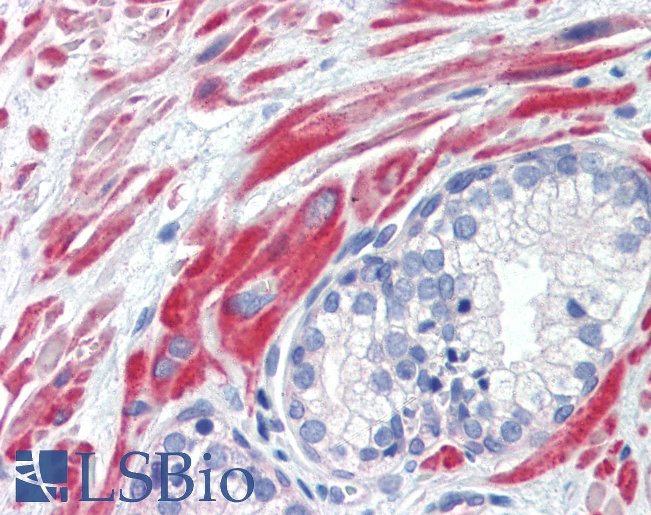 Polyclonal Rabbit anti-Human SSX4 Antibody (aa108-157, IHC, WB)