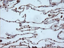 MAP2K1 / MKK1 / MEK1 Antibody (clone OTI3H5)