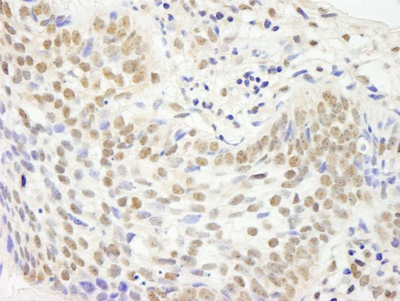 Polyclonal Rabbit anti-Human JHDM1A / KDM2A Antibody (aa825-875, IHC)