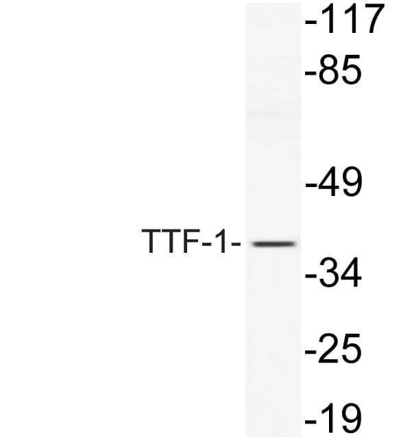 NKX2-1 / Thyroid-Specific TF Antibody (aa27-76)