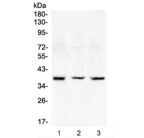 RAD51 / RECA Antibody