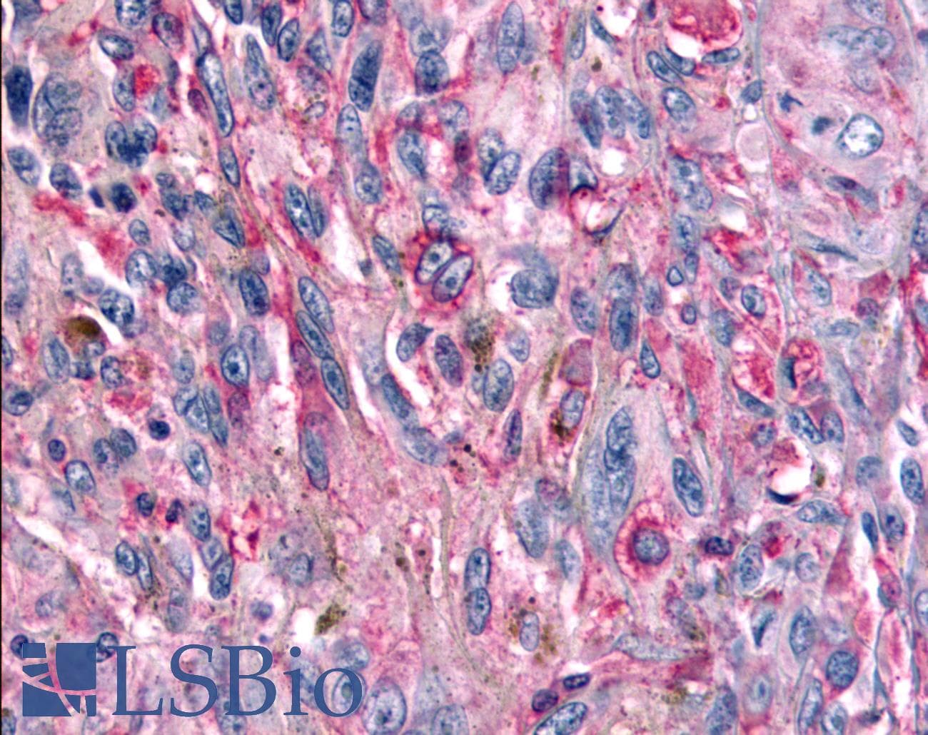 PathPlus™ GRM6 / MGLUR6 Antibody (N-Terminus)