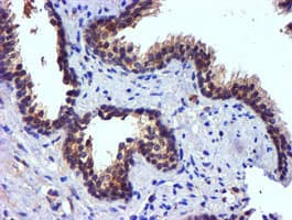 PDSS2 / DLP1 Antibody (clone OTI1D10)
