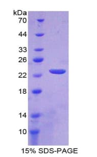 Human IL37 Protein (Recombinant His-T7)