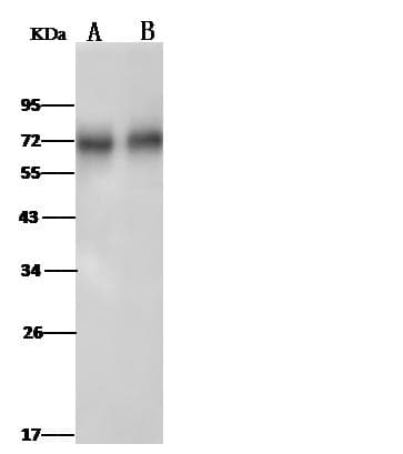 NT5E / eNT / CD73 Antibody (Preservative Free)