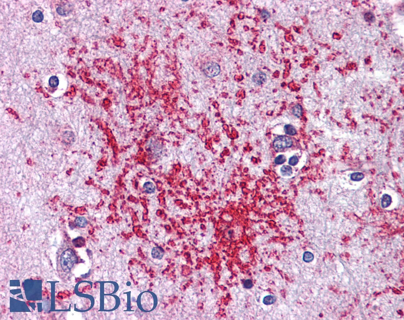 IHC-plus™ PLK1 / PLK-1 Antibody