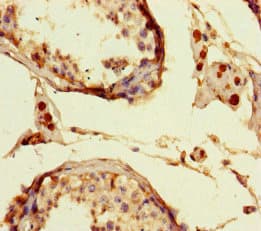 Polyclonal Rabbit anti-Human LIG3 / DNA Ligase III Antibody (IHC, IF)