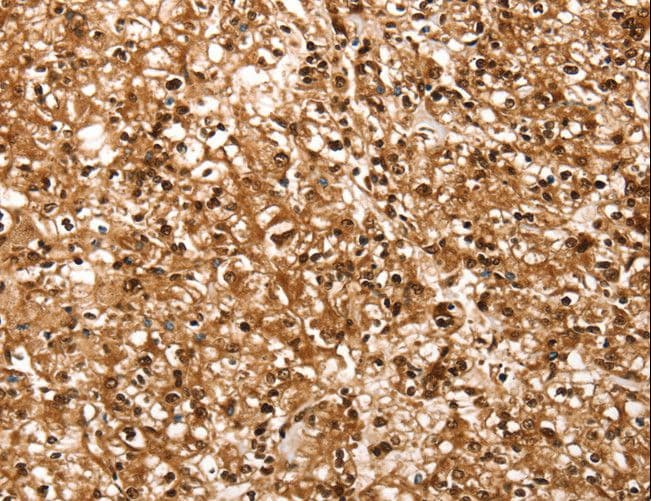 RBM5 / G15 Antibody