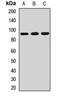 Polyclonal Rabbit anti-Human ACBD5 Antibody (WB)