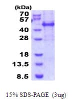Human MEIS3 Protein (Recombinant His)