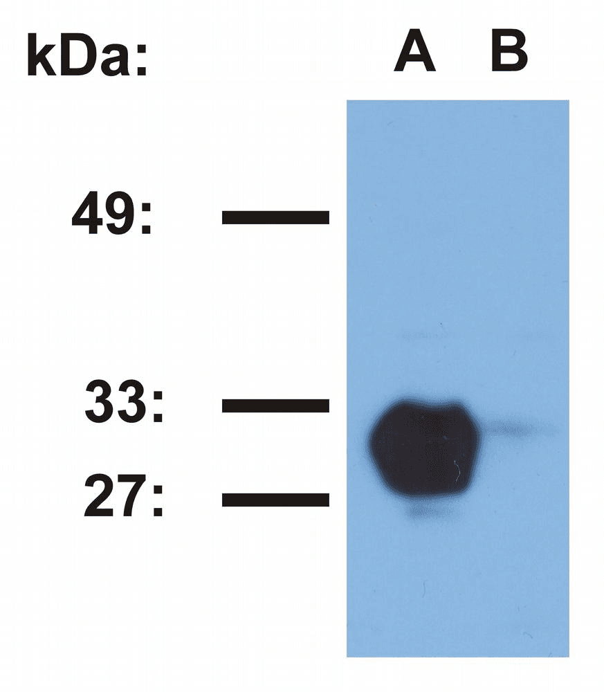 HLA-DR1 Antibody (clone MEM-267)