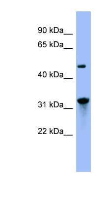 Polyclonal Rabbit anti-Human NIT1 Antibody (aa71-120, WB)