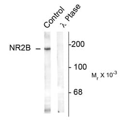 Polyclonal Rabbit anti-Rat GRIN2B / NMDAR2B / NR2B Antibody (phospho-Tyr1336, WB)