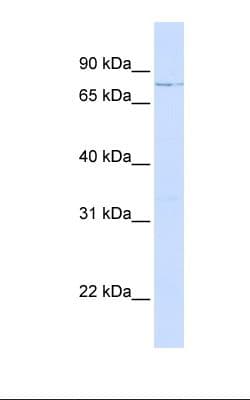 Polyclonal Rabbit anti-Human LCP1 / L-Plastin Antibody (aa74-123, WB)